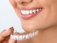 Диагностика лечения на элайнерах – 5 000 рублей